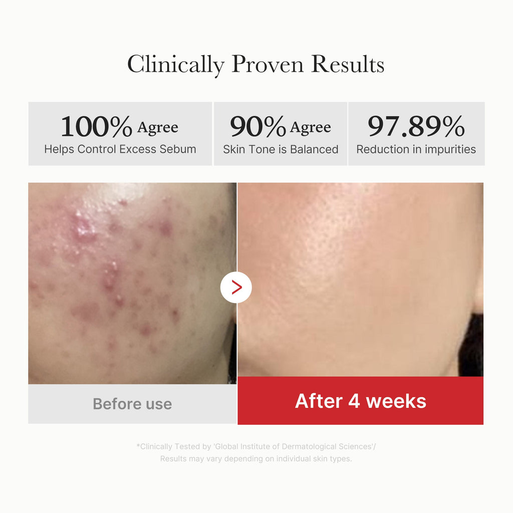 Texture des Medicube Red Succinic Acid Panthenol Pads